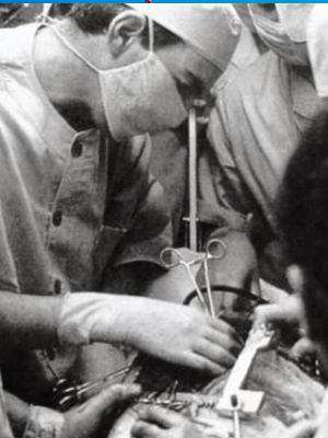 trasplante de órgano, Christiaan Barnard