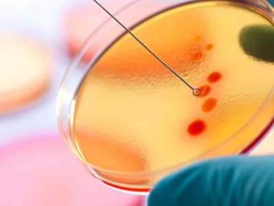 Historia de la Microbiologia